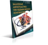 Баллонная ангиопластика при ишемии нижних конечностей