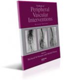 Peripheral Vascular Interventions